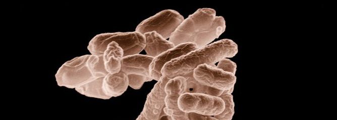 Bild på bakterier av arten E.coli