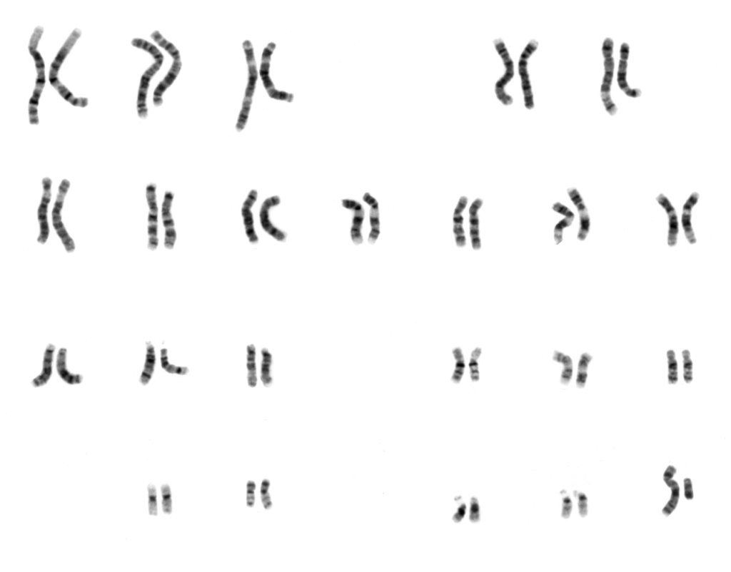 En karyotyp som visar en människas alla kromosomer. 