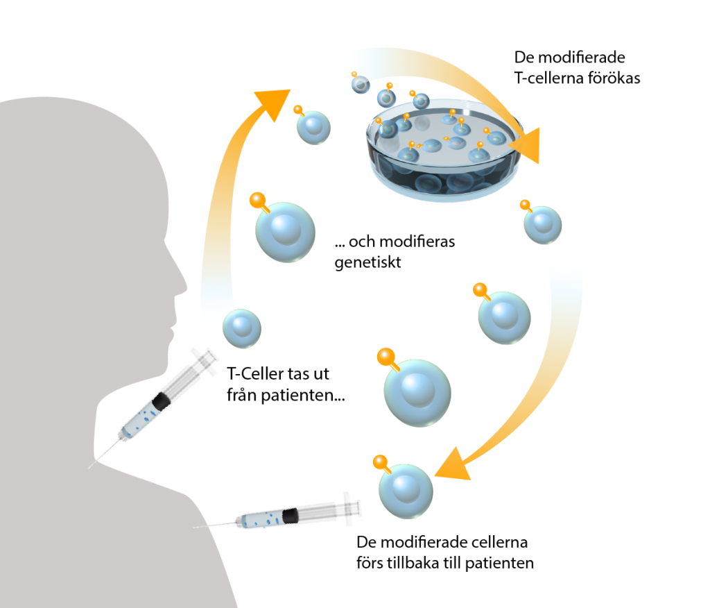 illustration av hur en CAR-T-cellterapi går till